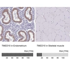 Anti-TMED10 Antibody