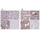 Immunohistochemical staining of human duodenum, endometrium, salivary gland and skeletal muscle using Anti-TMED10 antibody HPA050539 (A) shows similar protein distribution across tissues to independent antibody HPA047139 (B).