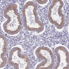 Immunohistochemical staining of human endometrium shows moderate granular cytoplasmic positivity in glandular cells.