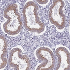 Immunohistochemical staining of human endometrium shows moderate granular cytoplasmic positivity in glandular cells.