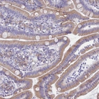 Immunohistochemical staining of human duodenum shows moderate granular cytoplasmic positivity in glandular cells.