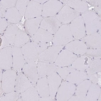 Immunohistochemical staining of human skeletal muscle shows no positivity in myocytes as expected.