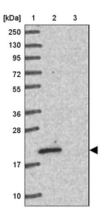 Lane 1: Marker [kDa] 250, 130, 95, 72, 55, 36, 28, 17, 10_br/_Lane 2: Human cell line RT-4_br/_Lane 3: Human cell line U-251MG sp