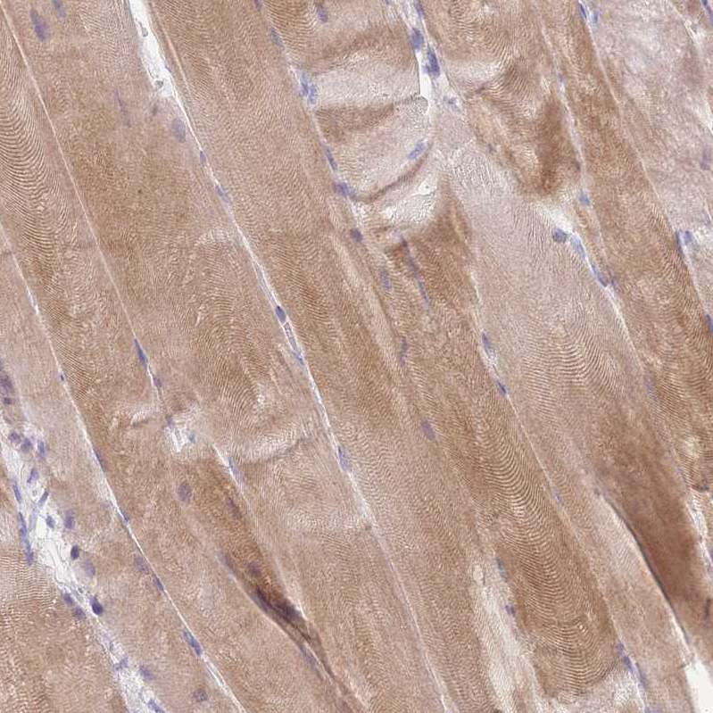 Anti-NDUFAF6 Antibody