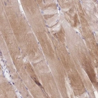 Anti-NDUFAF6 Antibody