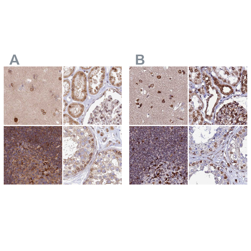 Anti-TOR1AIP1 Antibody