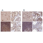 Anti-TOR1AIP1 Antibody
