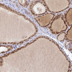 Anti-TOR1AIP1 Antibody