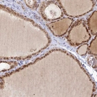 Immunohistochemical staining of human thyroid gland shows strong positivity in nuclear membrane in glandular cells.