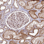 Anti-TOR1AIP1 Antibody