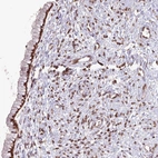 Immunohistochemical staining of human cervix, uterine shows strong positivity in nuclear membrane in glandular cells.