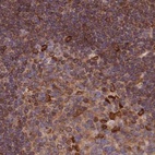 Anti-TOR1AIP1 Antibody