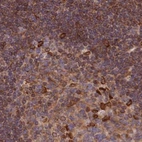 Immunohistochemical staining of human lymph node using Anti-TOR1AIP1 antibody HPA050546.