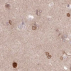 Immunohistochemical staining of human cerebral cortex using Anti-TOR1AIP1 antibody HPA050546.