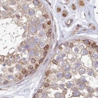 Immunohistochemical staining of human testis using Anti-TOR1AIP1 antibody HPA050546.