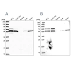 Western blot analysis using Anti-TOR1AIP1 antibody HPA050546 (A) shows similar pattern to independent antibody HPA047151 (B).