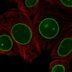 Immunofluorescent staining of human cell line MCF7 shows localization to nuclear membrane.