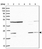 Lane 1: Marker [kDa] 250, 130, 95, 72, 55, 36, 28, 17, 10_br/_Lane 2: Human cell line RT-4_br/_Lane 3: Human cell line U-251MG sp_br/_Lane 4: Human plasma (IgG/HSA depleted)_br/_Lane 5: Human liver tissue_br/_Lane 6: Human tonsil tissue