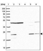 Lane 1: Marker [kDa] 250, 130, 95, 72, 55, 36, 28, 17, 10_br/_Lane 2: Human cell line RT-4_br/_Lane 3: Human cell line U-251MG sp_br/_Lane 4: Human plasma (IgG/HSA depleted)_br/_Lane 5: Human liver tissue_br/_Lane 6: Human tonsil tissue