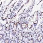 Immunohistochemical staining of human duodenum shows positivity in glandular cells.
