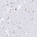 Immunohistochemical staining of human cerebral cortex shows positivity in neurons.