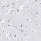 Immunohistochemical staining of human cerebral cortex shows positivity in neurons.