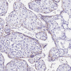 Immunohistochemical staining of human placenta shows positivity in trophoblastic cells.