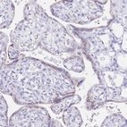 Immunohistochemical staining of human placenta shows positivity in trophoblastic cells.