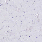 Immunohistochemical staining of human skeletal muscle shows no positivity in myocytes as expected.