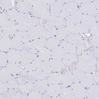 Immunohistochemical staining of human skeletal muscle shows no positivity in myocytes as expected.