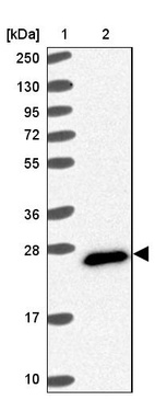 Lane 1: Marker [kDa] 250, 130, 95, 72, 55, 36, 28, 17, 10_br/_Lane 2: Human cell line RT-4