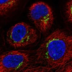 Immunofluorescent staining of human cell line A-431 shows localization to the Golgi apparatus.