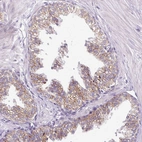 Immunohistochemical staining of human prostate shows moderate granular cytoplasmic positivity in glandular cells.