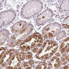 Immunohistochemical staining of human stomach shows strong granular cytoplasmic positivity in glandular cells.