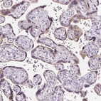 Immunohistochemical staining of human placenta shows weak granular cytoplasmic positivity in trophoblastic cells.