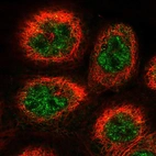 Immunofluorescent staining of human cell line A-431 shows localization to nucleoplasm.