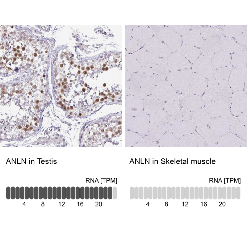 Anti-ANLN Antibody