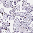 Immunohistochemical staining of human placenta shows moderate to strong nuclear positivity in a subset of trophoblastic cells.