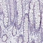 Immunohistochemical staining of human colon shows moderate to strong nuclear positivity in a subset of glandular cells.