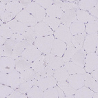 Immunohistochemical staining of human skeletal muscle shows no positivity in myocytes as expected.
