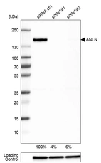 Western blot analysis in U-251MG cells transfected with control siRNA, target specific siRNA probe #1 and #2, using Anti-ANLN antibody. Remaining relative intensity is presented. Loading control: Anti-GAPDH.