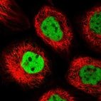 Immunofluorescent staining of human cell line A-431 shows localization to nucleoplasm.