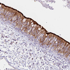 Immunohistochemical staining of human bronchus shows strong positivity in cilia in respiratory epithelial cells.