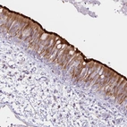 Immunohistochemical staining of human bronchus shows strong positivity in cilia in respiratory epithelial cells.