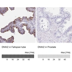 Immunohistochemistry analysis in human fallopian tube and prostate tissues using HPA050565 antibody. Corresponding DNAI2 RNA-seq data are presented for the same tissues.