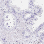 Immunohistochemical staining of human prostate shows no positivity in glandular cells as expected.