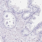 Immunohistochemical staining of human prostate shows no positivity in glandular cells as expected.