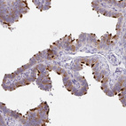 Immunohistochemical staining of human fallopian tube shows strong positivity in cilia in glandular cells.