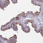 Anti-DNAI2 Antibody