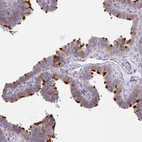 Immunohistochemical staining of human fallopian tube shows strong positivity in cilia in glandular cells.